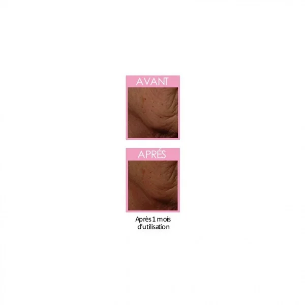 Claude Bell S.R.J.9 Soin Restructurant Des Joues Homme Boutique 5